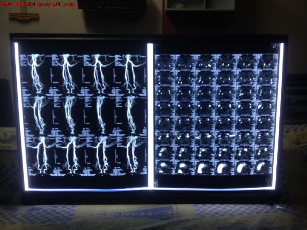 ince negatoskop fiyatlar�, negatoskop cihaz� nedir, lcd negatoskop fiyatlar� negatoskop nedir,