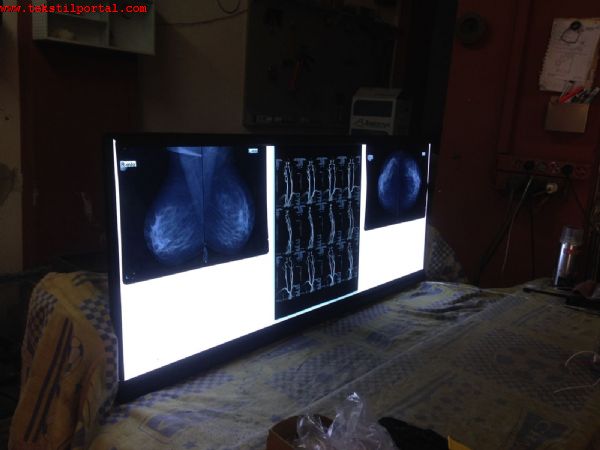r�ntgen filmi g�r�nt�leme, negatoskop cihaz� fiyat�, negatoskop cihaz� sat��,