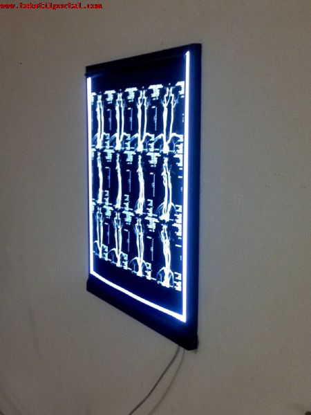 negatoskop cihaz�, negatoskop cihaz� ucuz, negatoskop cihaz� uygun,